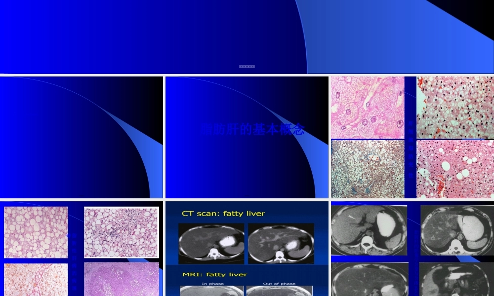 2022年医学专题—脂肪肝与动脉硬化(1).ppt