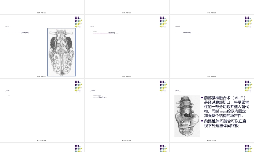 2022年医学专题—腰椎融合术(1).ppt