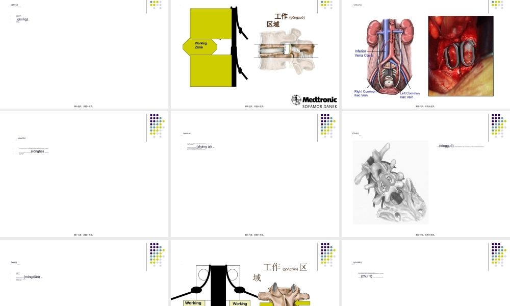 2022年医学专题—腰椎融合术(1).ppt