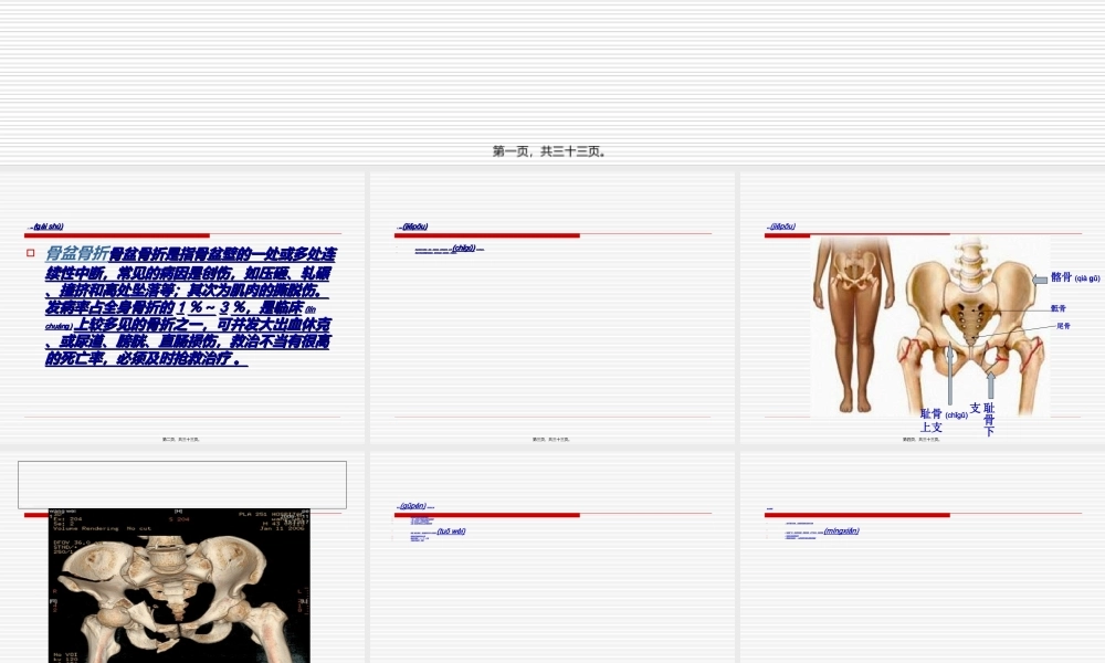 2022年医学专题—新骨盆骨折(1).ppt