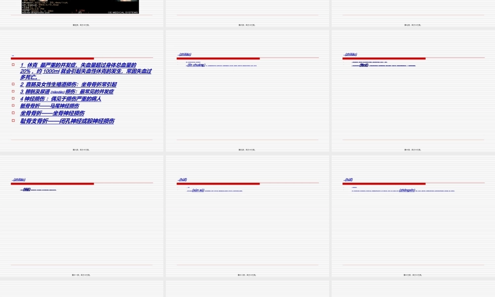 2022年医学专题—新骨盆骨折(1).ppt