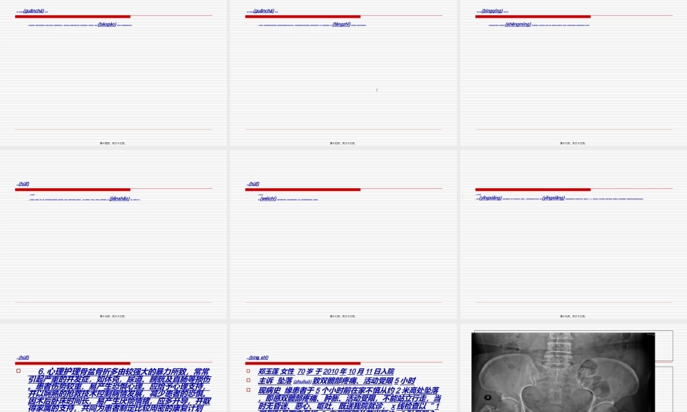 2022年医学专题—新骨盆骨折(1).ppt