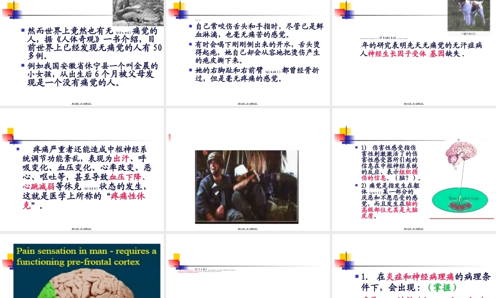 2022年医学专题—疼痛外周(1).ppt