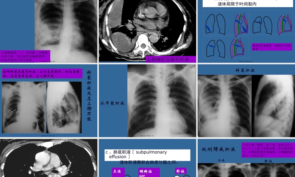呼吸系统二-3.13(1).pptx