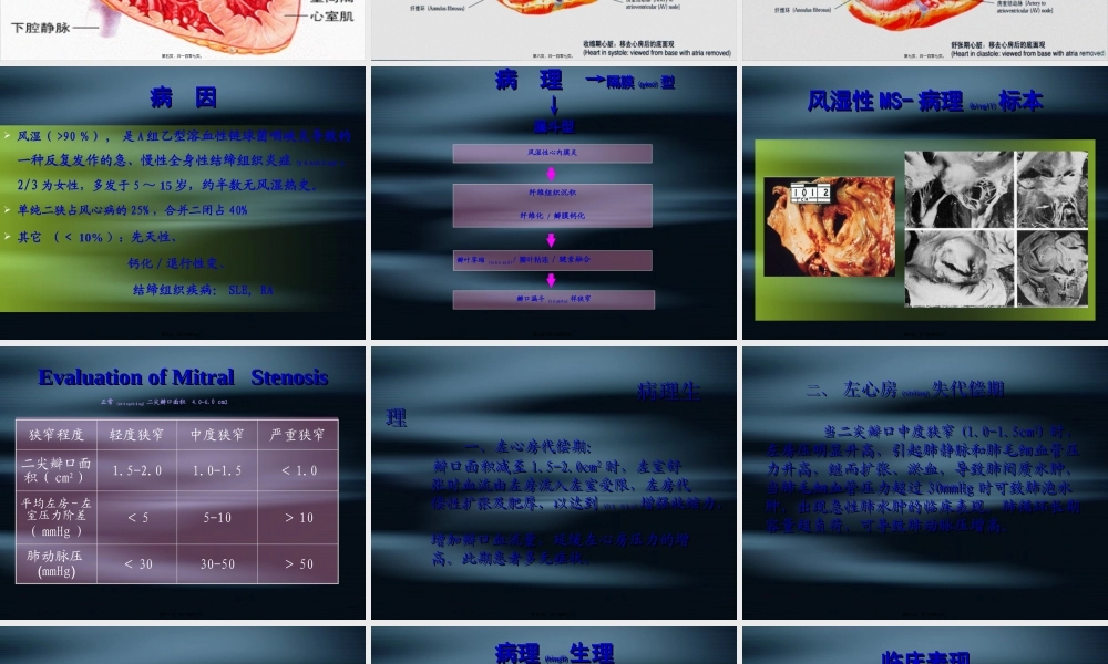 2022年医学专题—心脏瓣膜病(1).pptx