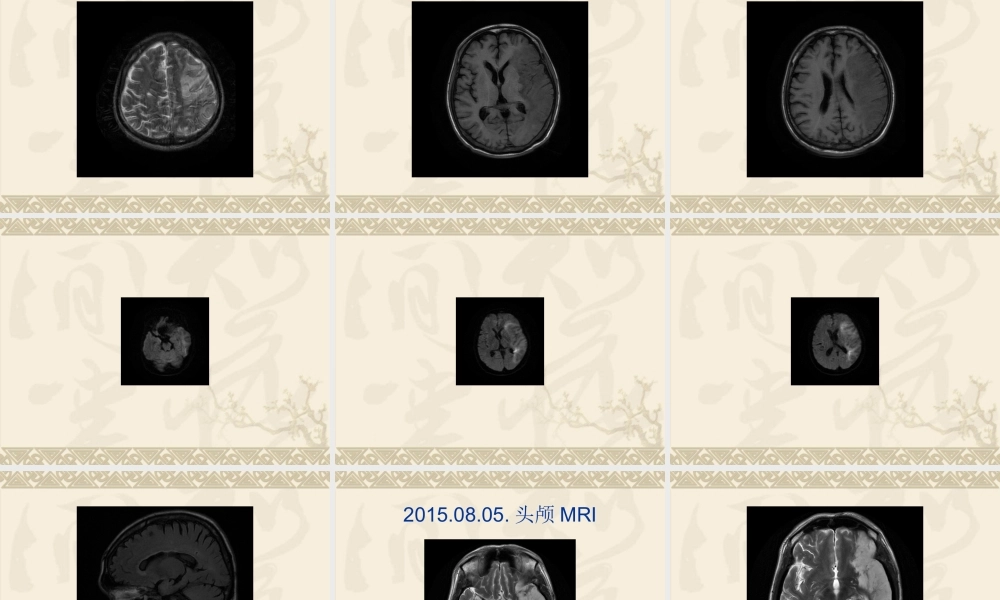 发热待查诊治思路2(1).ppt
