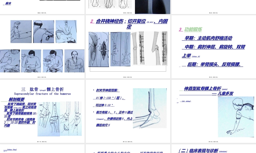 2022年医学专题—.2第六章-第二节上肢骨折(1).ppt