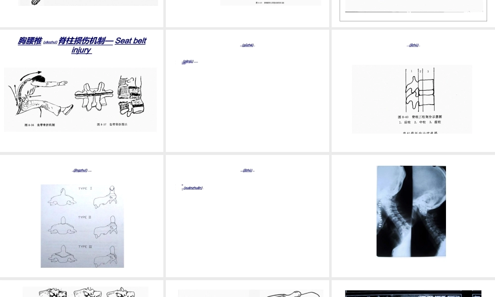 2022年医学专题—.4第六章-第四节躯干骨折(1).ppt