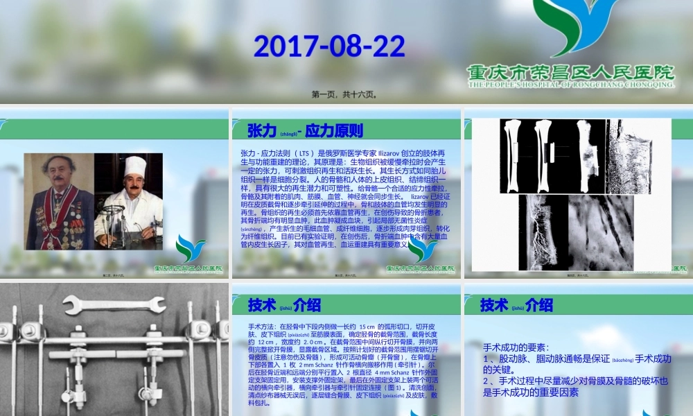 2022年医学专题—Ilizarov胫骨横向骨搬移微循环重建技术(1).pptx