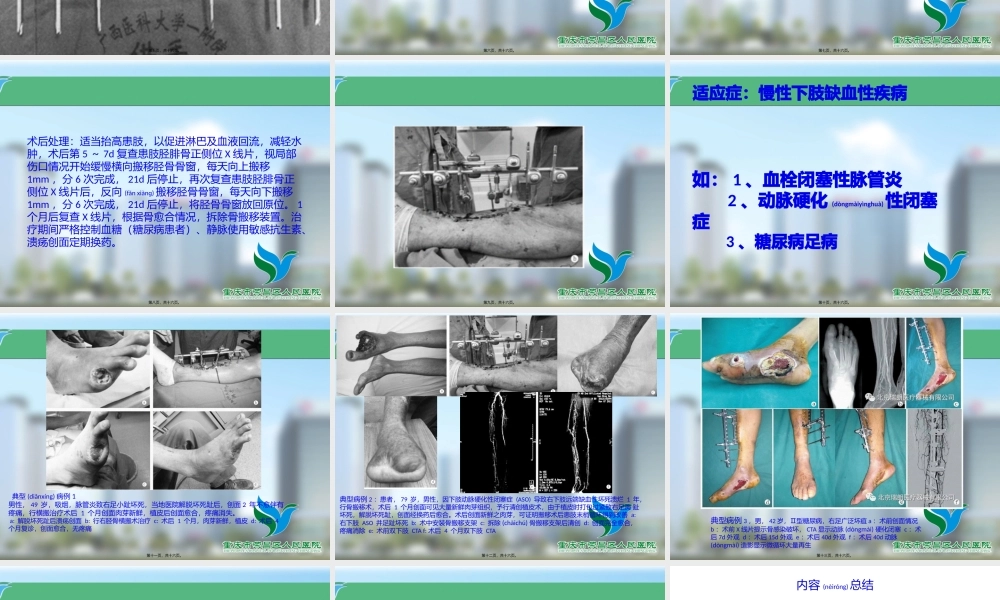 2022年医学专题—Ilizarov胫骨横向骨搬移微循环重建技术(1).pptx