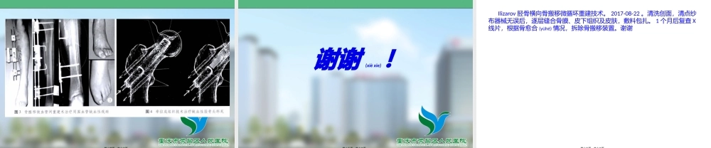 2022年医学专题—Ilizarov胫骨横向骨搬移微循环重建技术(1).pptx