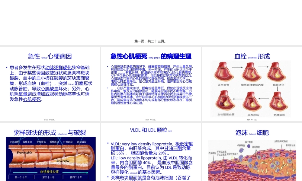 2022年医学专题—PCI与心梗一包药(1).pptx