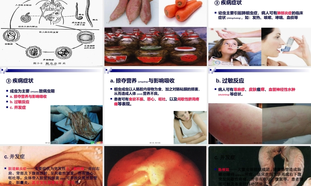 2022年医学专题—《烹饪营养与卫生》-第十六讲-食源性寄生虫病及其控制A-2012优化版(1).ppt