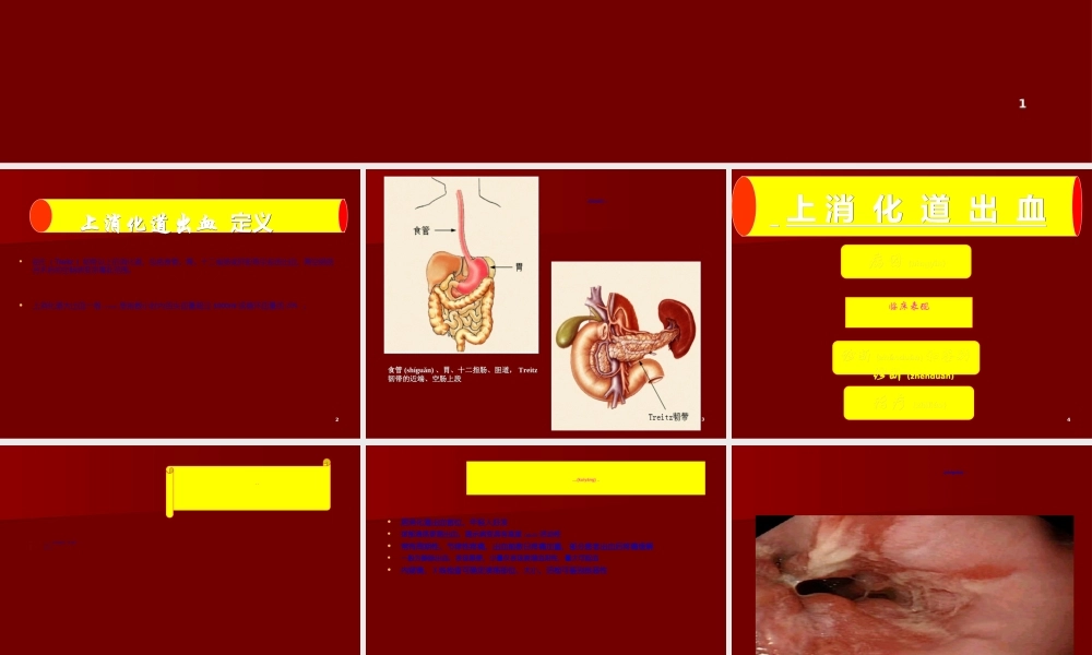 2022年医学专题—上消化道出血33(1).ppt