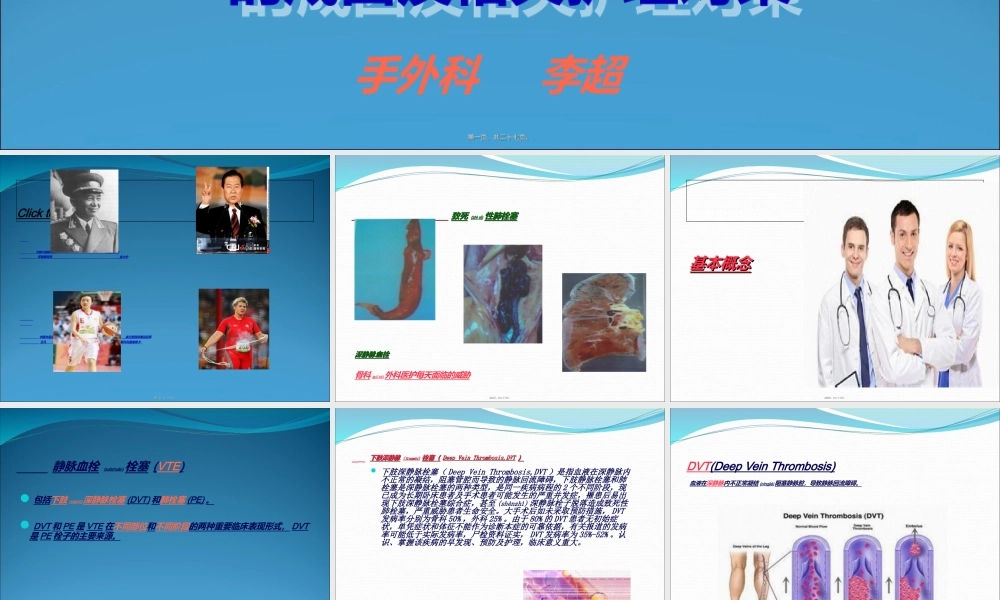 2022年医学专题—下肢深静脉栓塞(1).ppt
