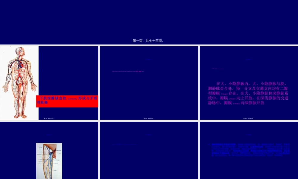 2022年医学专题—下肢静脉血栓详解(1).ppt