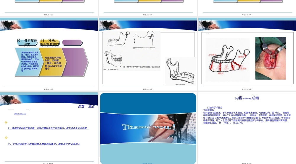 2022年医学专题—下颌骨骨折切开复位内固定术(1).ppt