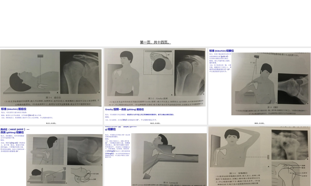 2022年医学专题—不同肩关节X线投照位(1).ppt