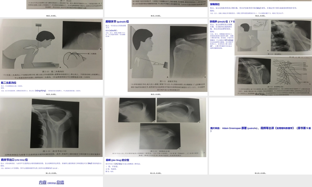 2022年医学专题—不同肩关节X线投照位(1).ppt