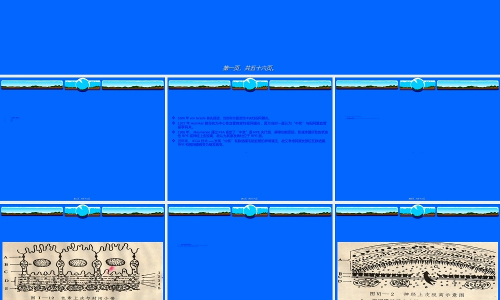 2022年医学专题—中心性浆液性脉络膜视网膜病变(1).ppt