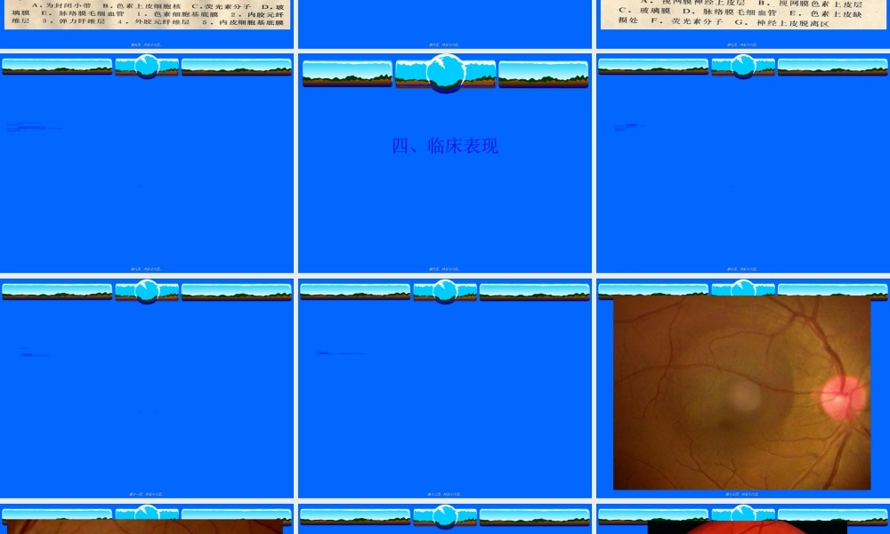 2022年医学专题—中心性浆液性脉络膜视网膜病变(1).ppt