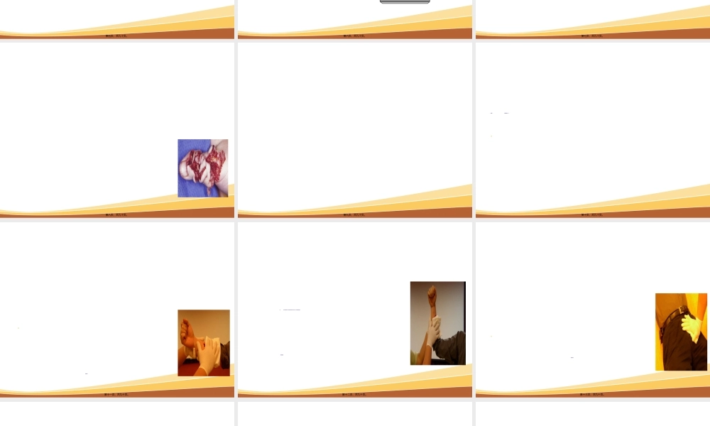 2022年医学专题—事故现场急救常识(1).ppt