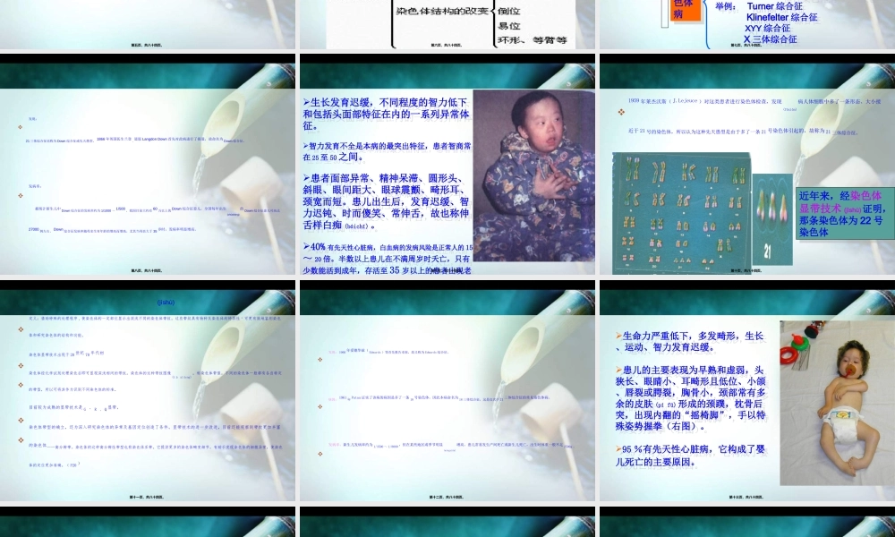 2022年医学专题—人类常见遗传病(1).ppt