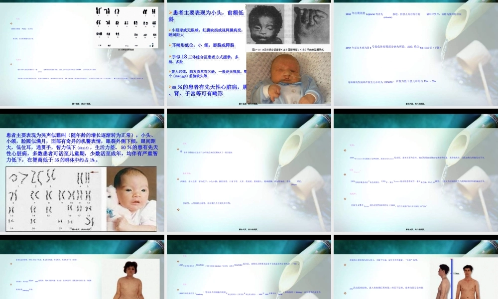 2022年医学专题—人类常见遗传病(1).ppt