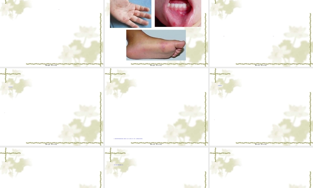 2022年医学专题—儿童常见感染及意外(1).ppt