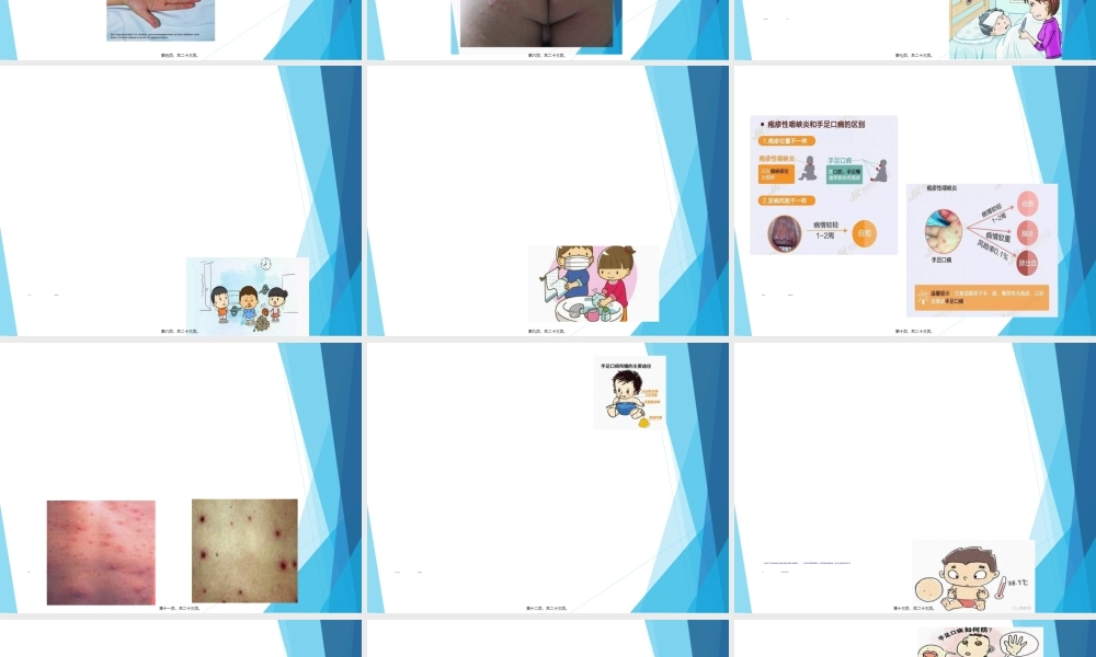 2022年医学专题—儿童手足口病防治PPT-2(1)(1).ppt