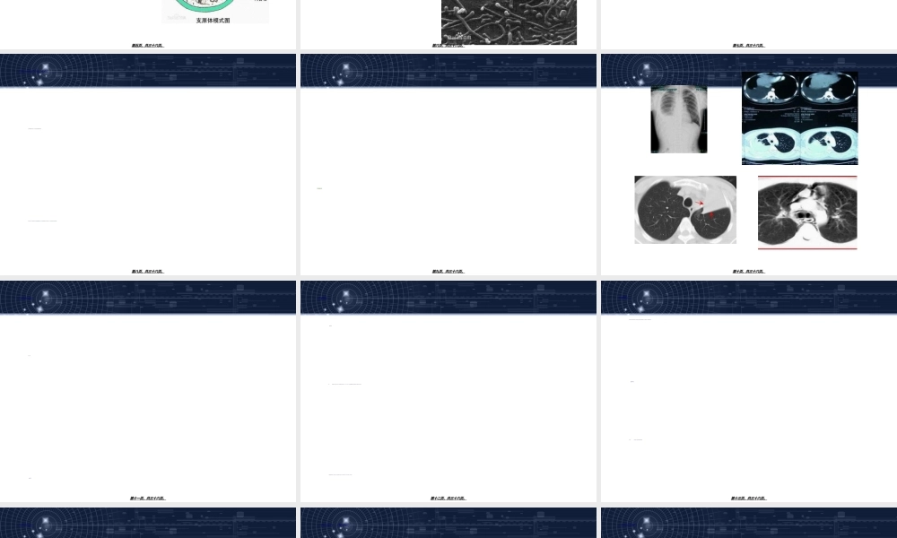 2022年医学专题—儿童肺炎支原体肺炎诊治专家共识(2015年版)解读1讲诉(1).ppt