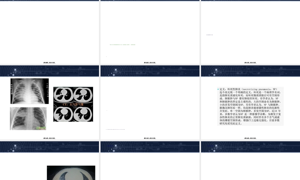 2022年医学专题—儿童肺炎支原体肺炎诊治专家共识(2015年版)解读1讲诉(1).ppt
