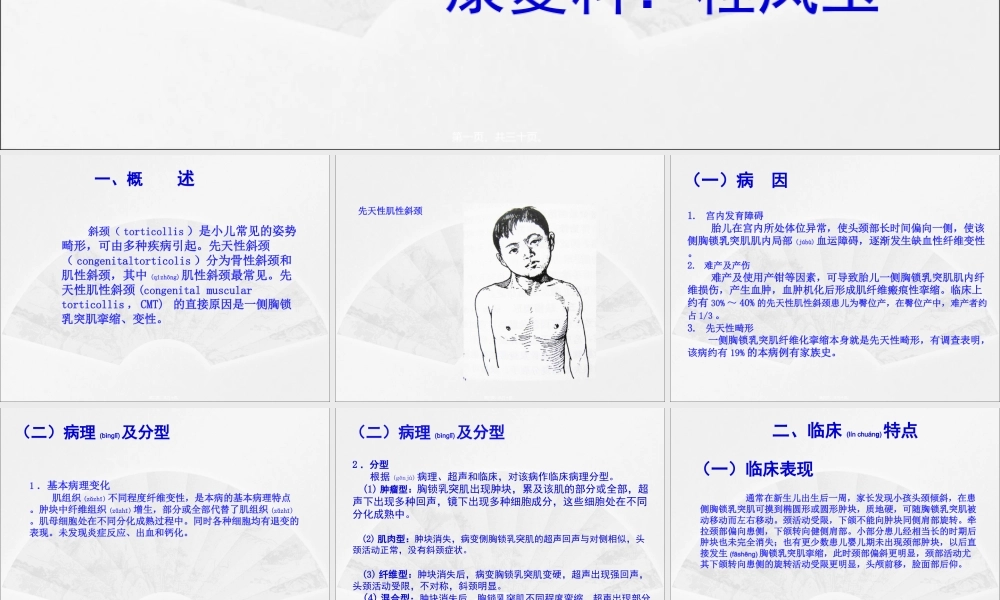 2022年医学专题—先天性肌性斜颈的康复(1).ppt