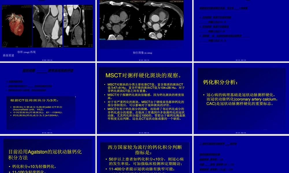 2022年医学专题—冠状动脉CTA成像(1).ppt