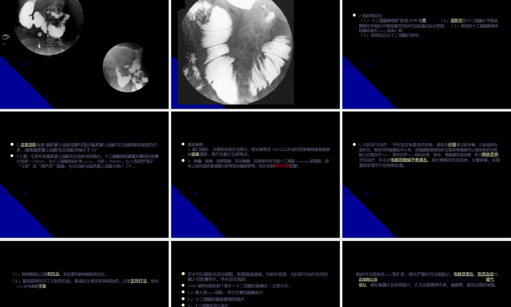 2022年医学专题—十二指肠淤积症(1).ppt