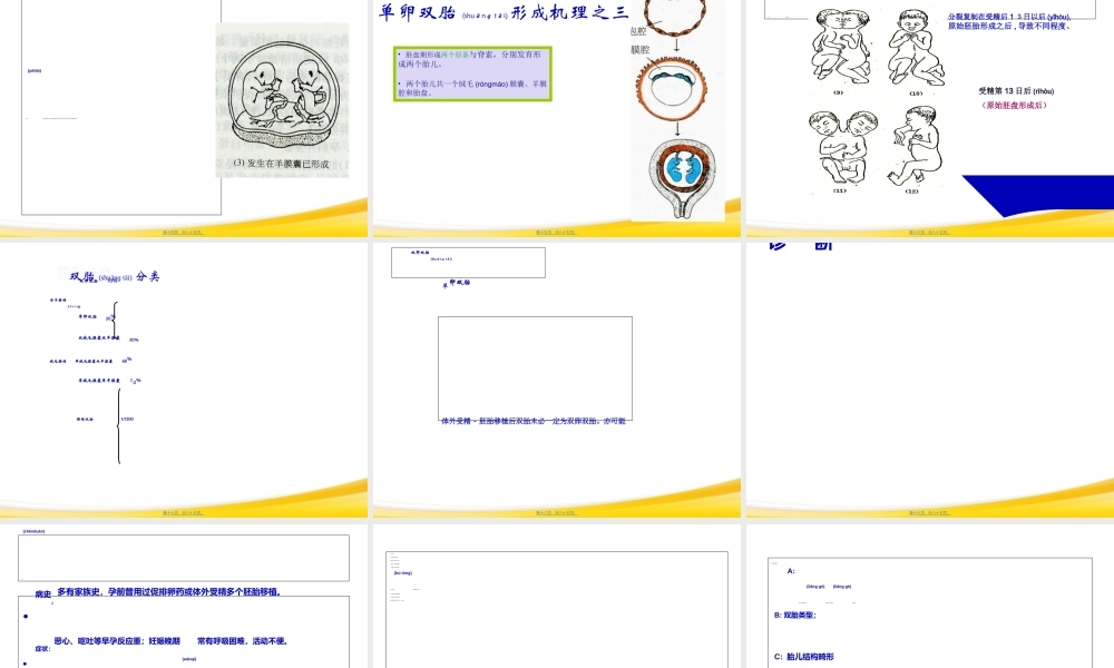 2022年医学专题—双胎妊娠与巨大胎儿-精选文档(1).ppt