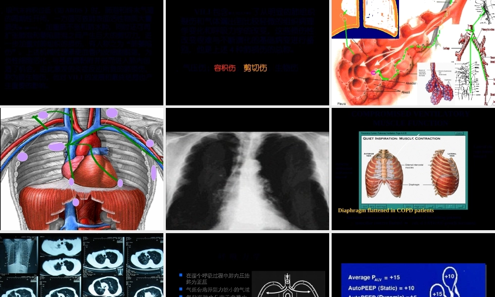 2022年医学专题—呼吸机并发症(1).ppt