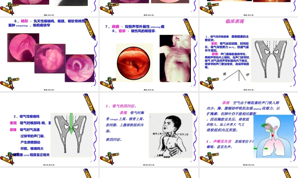 2022年医学专题—喉梗阻(1).ppt