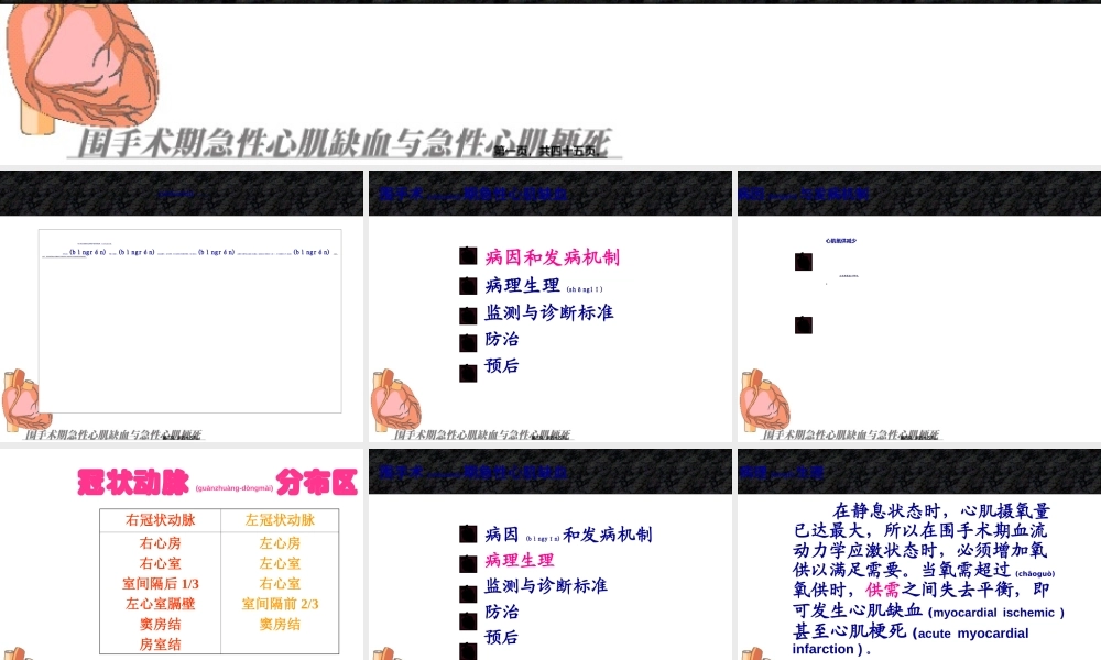 2022年医学专题—围手术期急性心肌缺血与心肌梗死(1).ppt