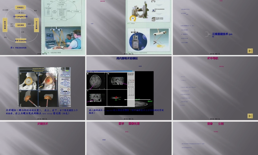 2022年医学专题—基于图像的外科手术导航系统(1).ppt
