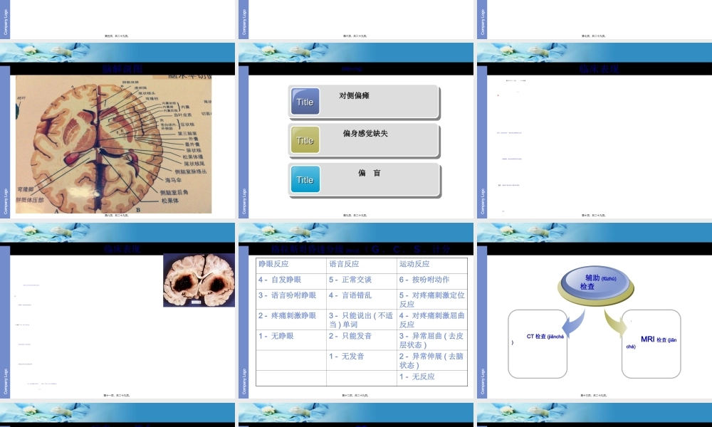 2022年医学专题—基底节区脑出血(1).ppt