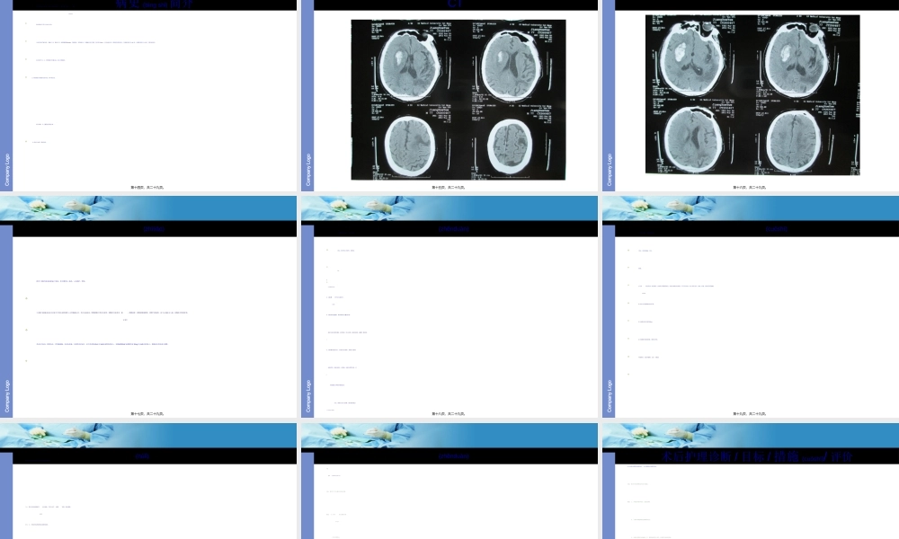 2022年医学专题—基底节区脑出血(1).ppt