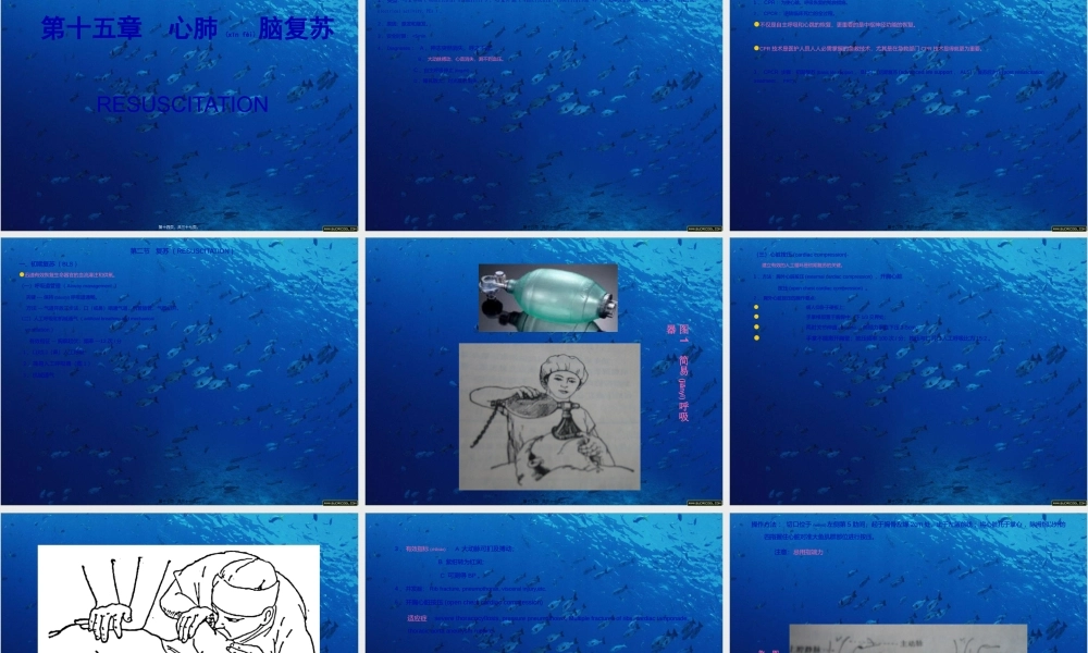 2022年医学专题—复苏、重症监测-2010-1(1).ppt