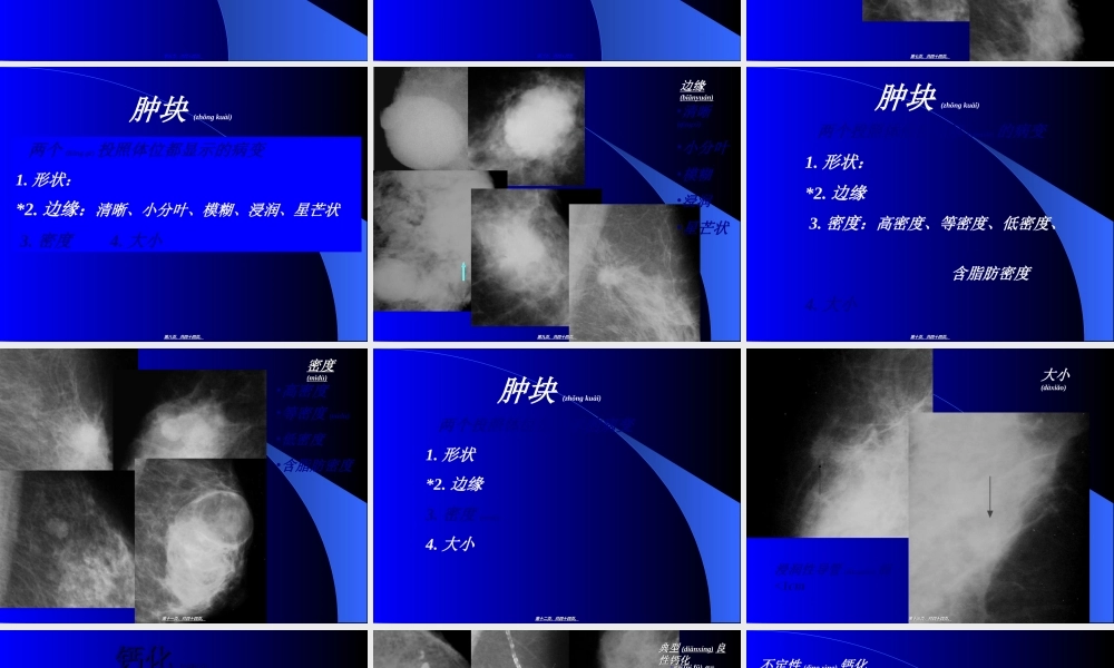 2022年医学专题—如何读懂乳腺钼靶片(1).ppt