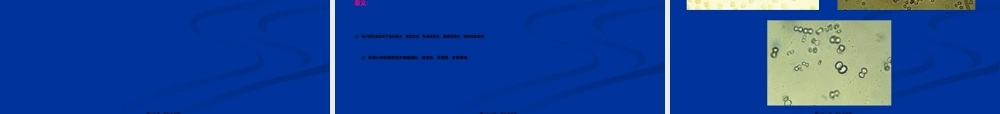 2022年医学专题—尿液、粪便检查详解(1).ppt
