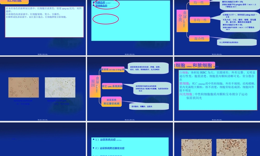 2022年医学专题—尿液显微镜检学检验(1).ppt
