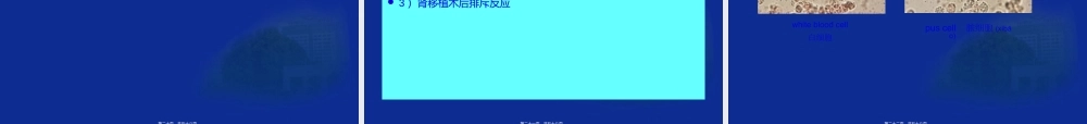 2022年医学专题—尿液显微镜检学检验(1).ppt