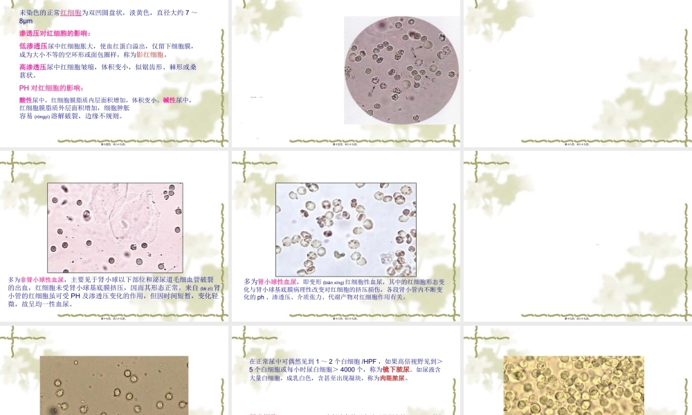 2022年医学专题—尿液有形成分及尿分析仪(1).ppt