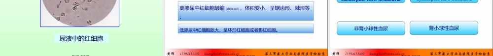 2022年医学专题—尿液有形成分显微镜检查(1).ppt
