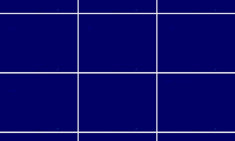 2022年医学专题—帕-金-森-氏-病研究(1).ppt